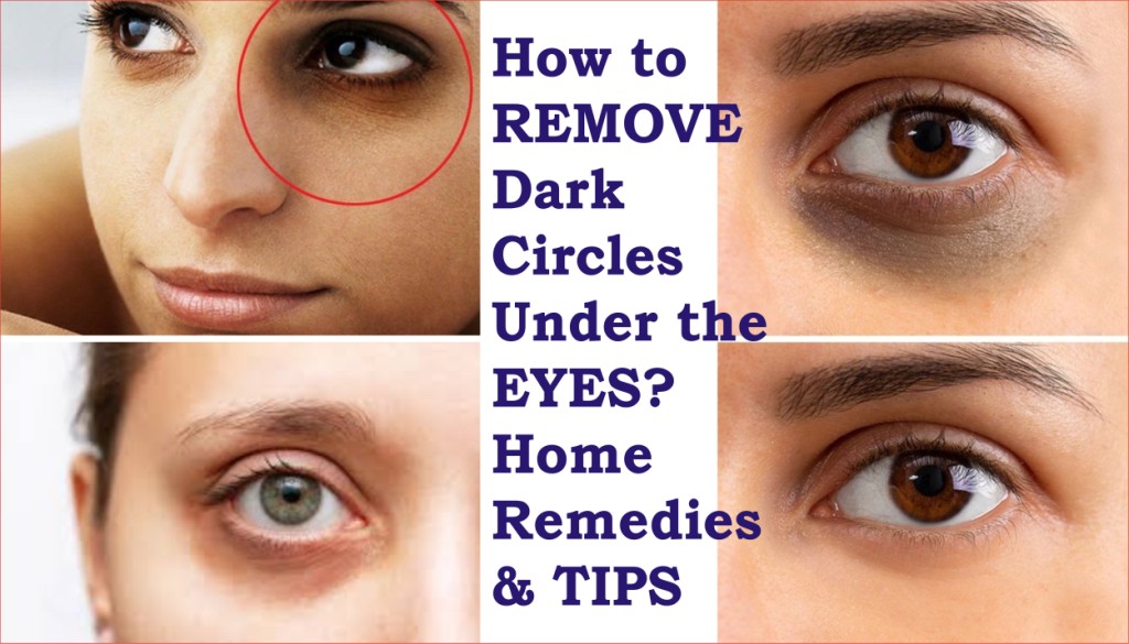 How to remove dark circles under the eyes at home. Home remedies and Tips